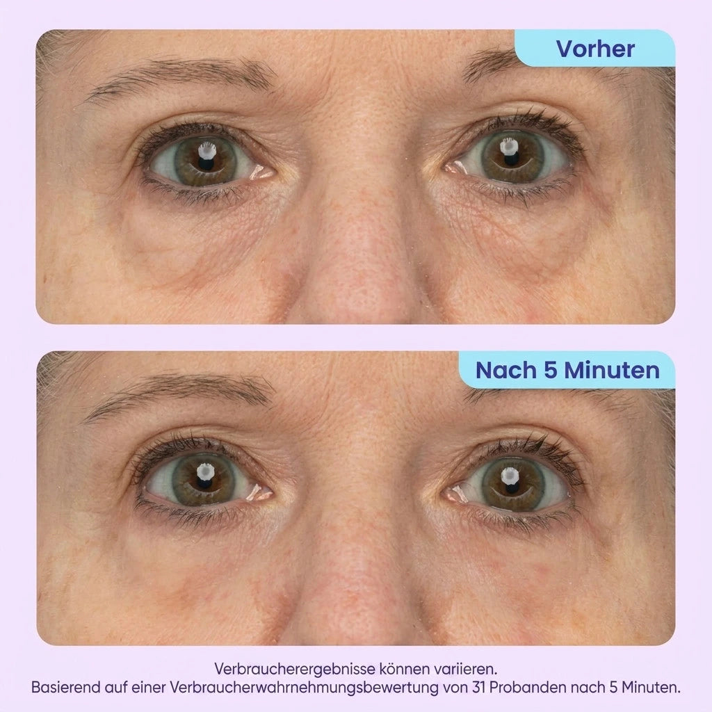 Eyevera